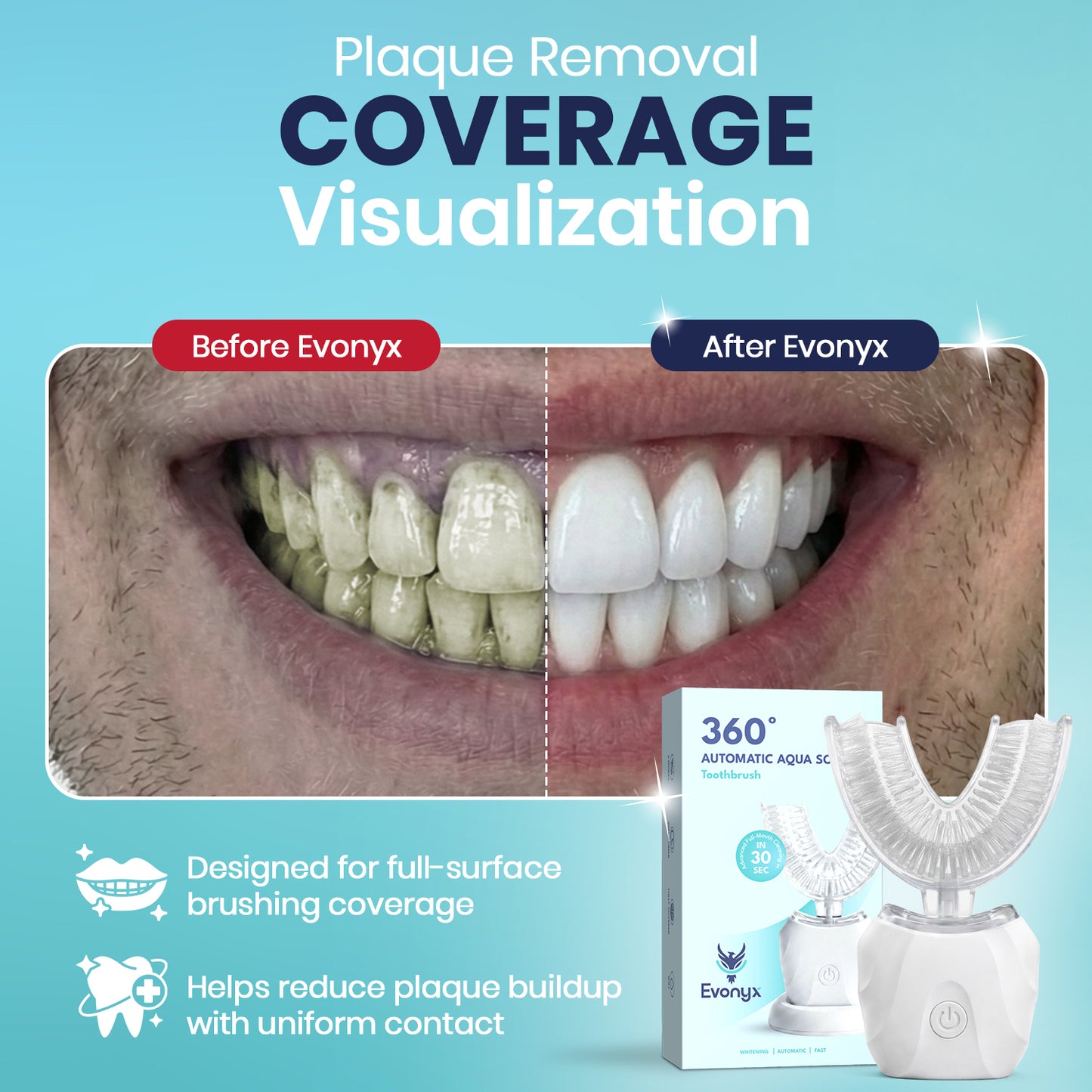 Evonyx Aqua™ – 30 Second Sonic Toothbrush