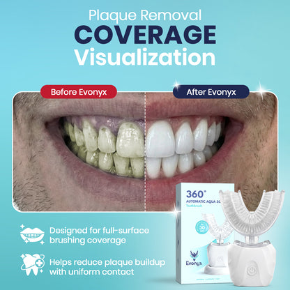 Evonyx Aqua™ – 30 Second Sonic Toothbrush